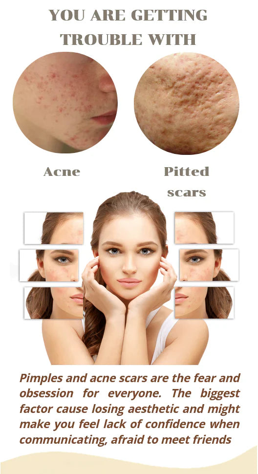 Niacinamide Serum For Acne, Pimples and Scar (Buy 1 Get 1 Free)