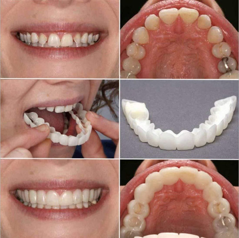 Perfect Calcium Teeth Aligner