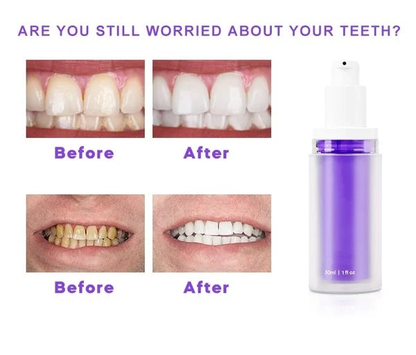 Purple Teeth Corrector (Buy 1 Get 1 Free)