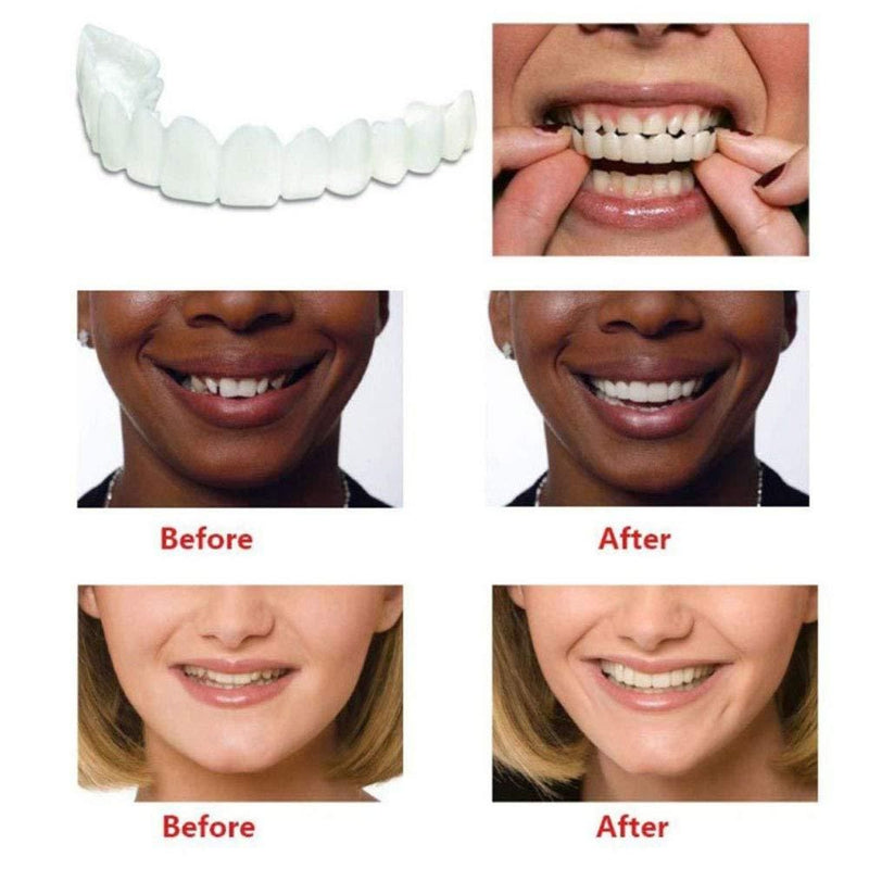 Perfect Calcium Teeth Aligner