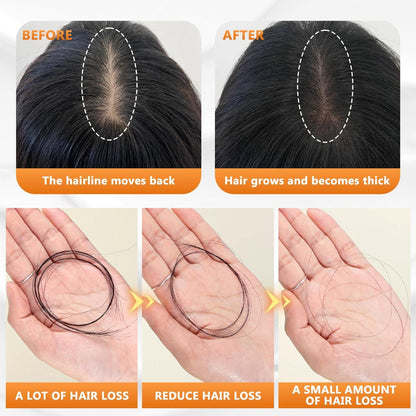 Japanese Natural Anti-Hair Fall Shampoo (Buy 1 Get 1 Free)