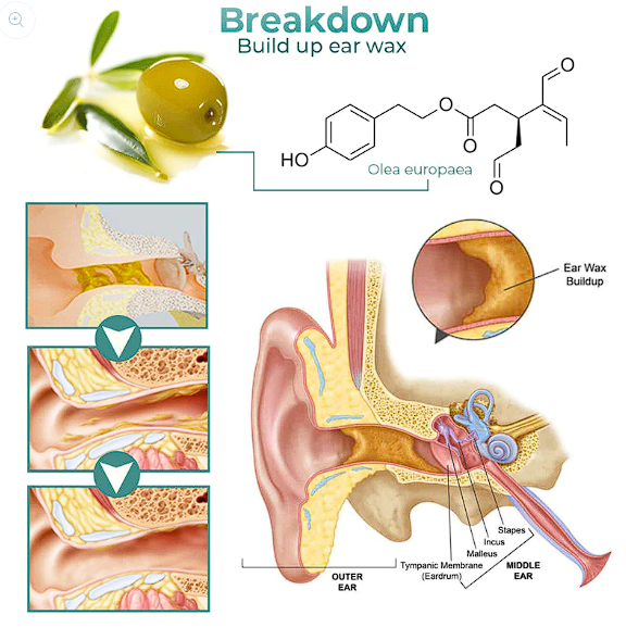 Tinnidrop Earwax & Anti-Cochlear Spray (Buy 1 Get 1 Free)