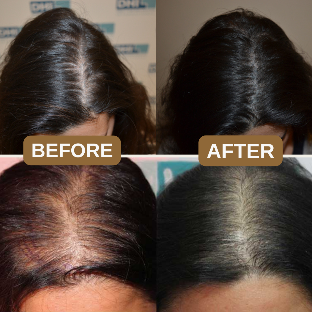 Japanese Natural Anti-Hair Fall Shampoo (Buy 1 Get 1 Free)