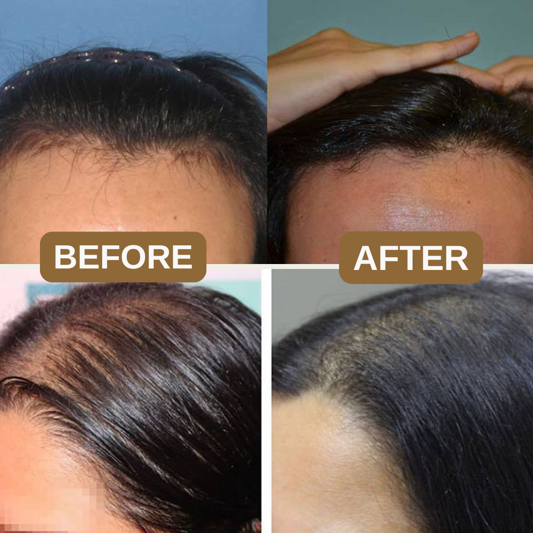 Japanese Natural Anti-Hair Fall Shampoo (Buy 1 Get 1 Free)