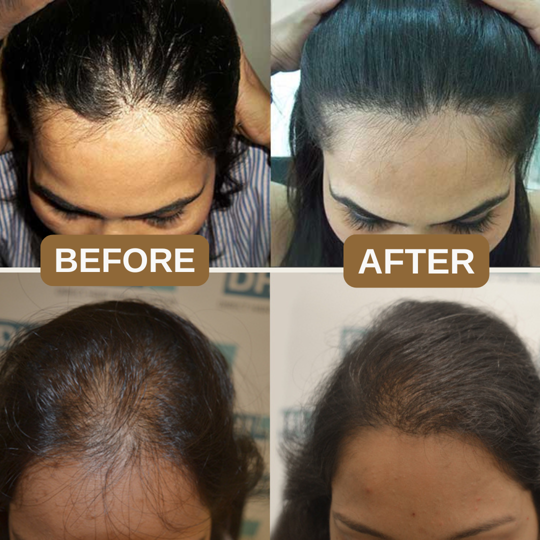 Japanese Natural Anti-Hair Fall Shampoo (Buy 1 Get 1 Free)