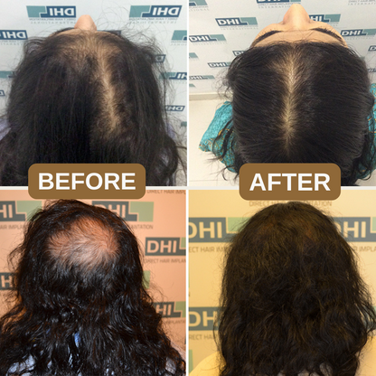 Japanese Natural Anti-Hair Fall Shampoo (Buy 1 Get 1 Free)