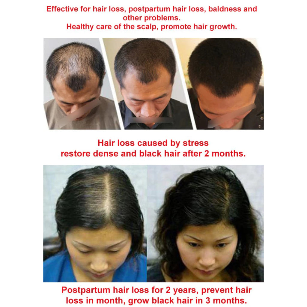 Japanese Natural Anti-Hair Fall Shampoo (Buy 1 Get 1 Free)