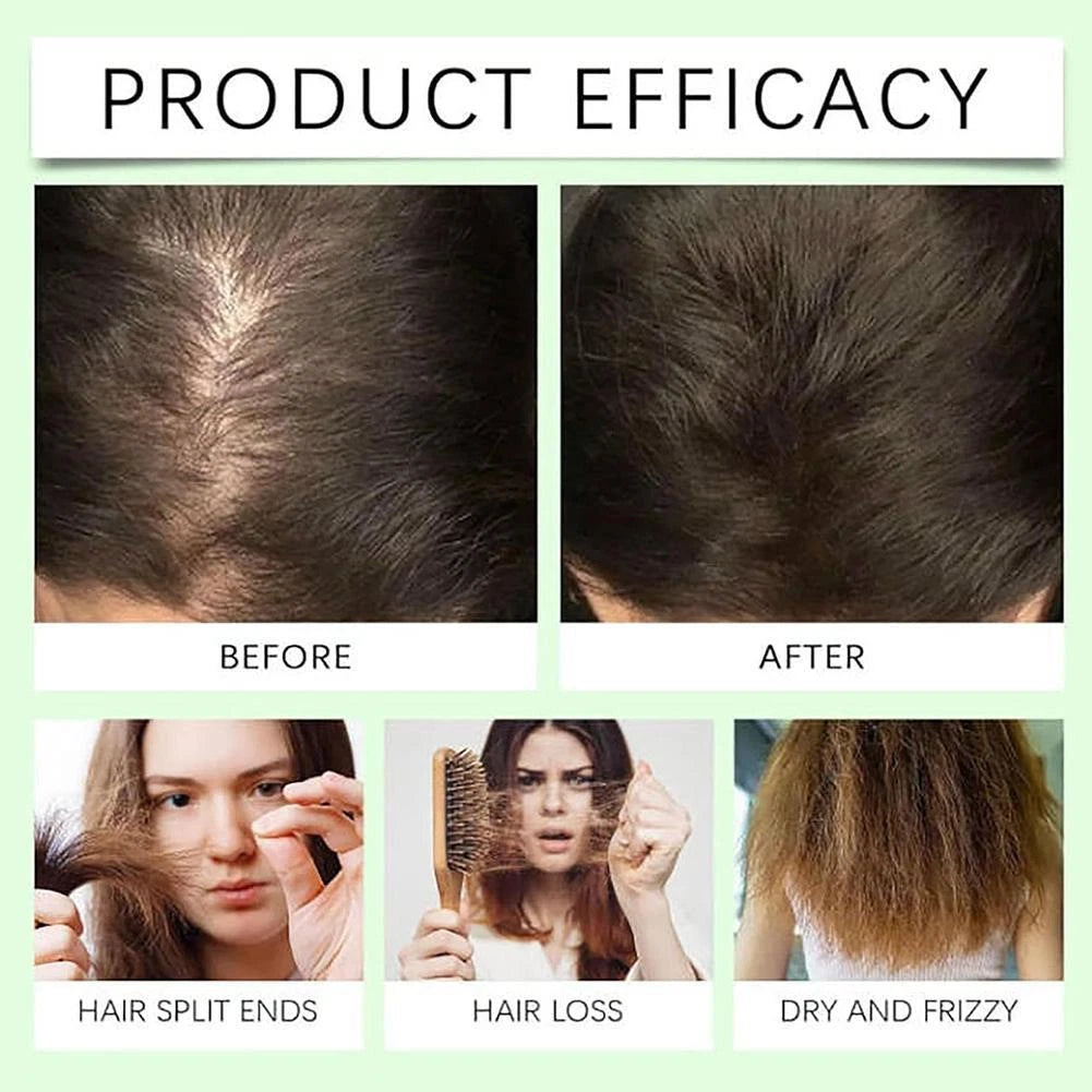 Japanese Natural Anti-Hair Fall Shampoo (Buy 1 Get 1 Free)