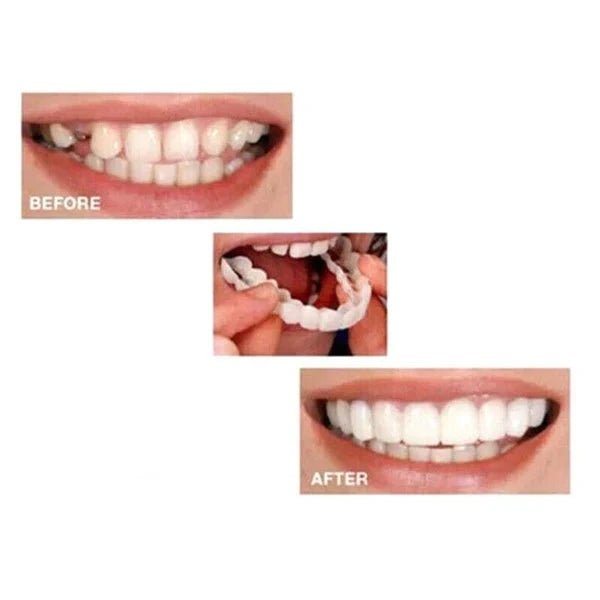 Perfect Calcium Teeth Aligner